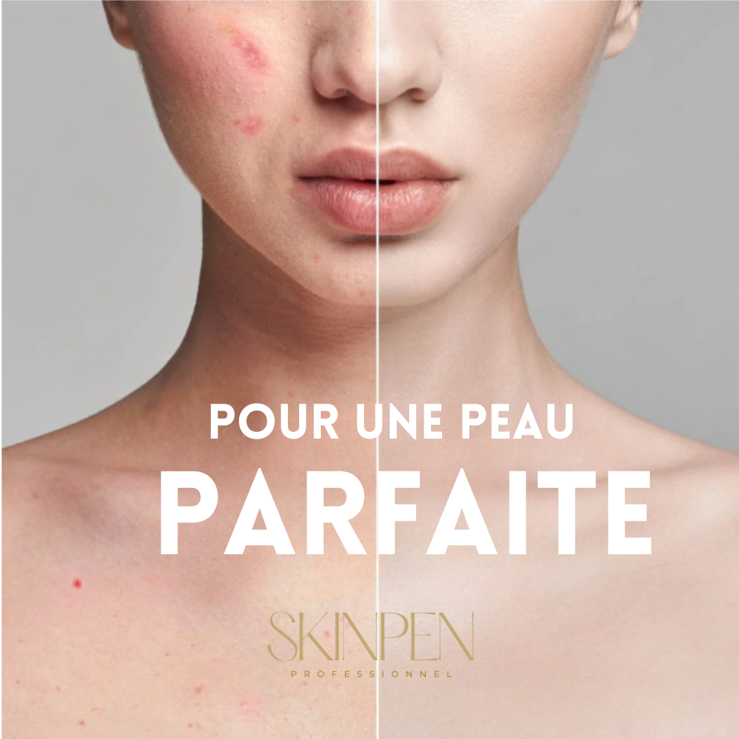 SkinPen Professionnel